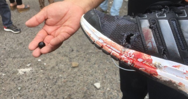Tras reprimirlos brutalmente, abren sumarios contra los estatales neuquinos Tras reprimirlos brutalmente, abren sumarios contra los estatales neuquinos