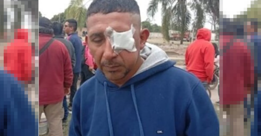 Salta: la fiscalía pidió la detención de gremialistas y trabajadores tras la protesta municipal en Hipólito Yrigoyen que terminó con varios heridos