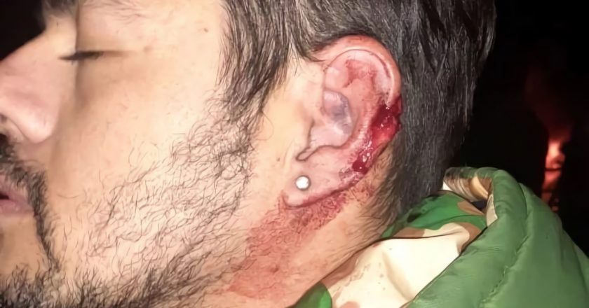 Choferes marplatenses de huelga denuncian que la UTA envió una patota que los atacó a tiros