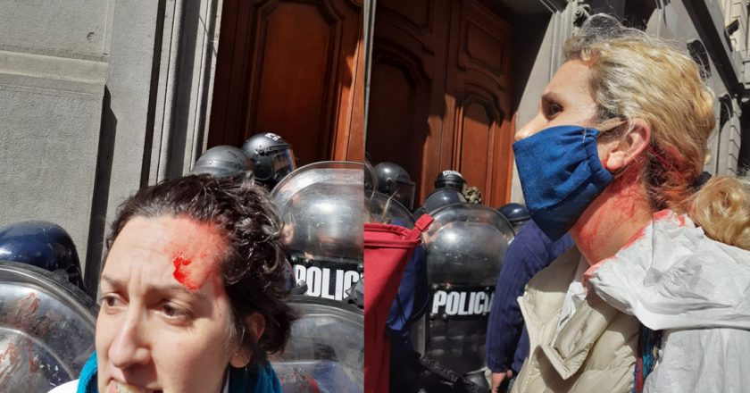 Se calienta el jueves porteño: la Asociación de Enfermería se suma al paro que ATE Salud le hace a Larreta