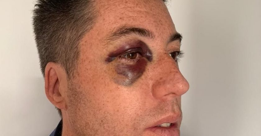 Un grupo de la UOCRA le dio una golpiza al secretario de Obras y Servicios Públicos de Trelew